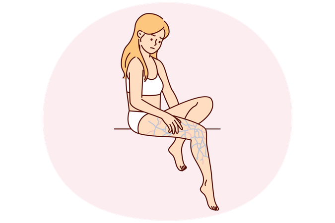 Une femme bouleversée en lingerie regarde avec perplexité sa jambe aux veines gonflées après une marche infructueuse  Illustration
