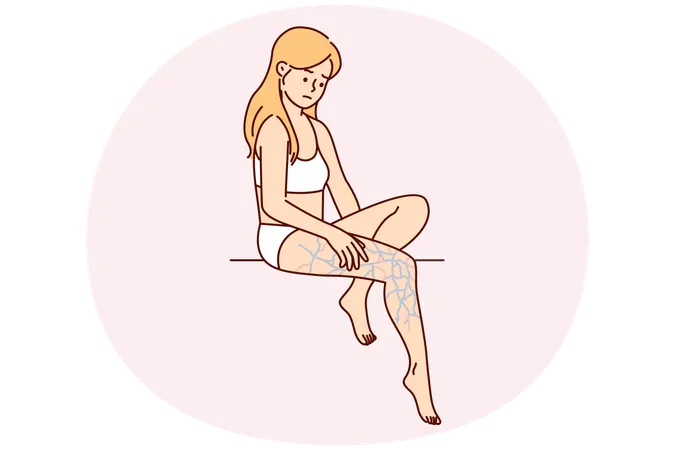 Une femme bouleversée en lingerie regarde avec perplexité sa jambe aux veines gonflées après une marche infructueuse  Illustration