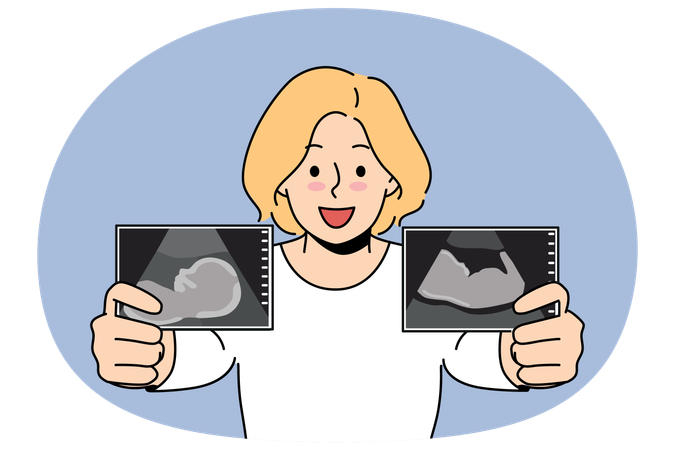 Une femme enceinte se vante d'images échographiques du bébé dans le ventre de la future mère pendant la période prénatale  Illustration