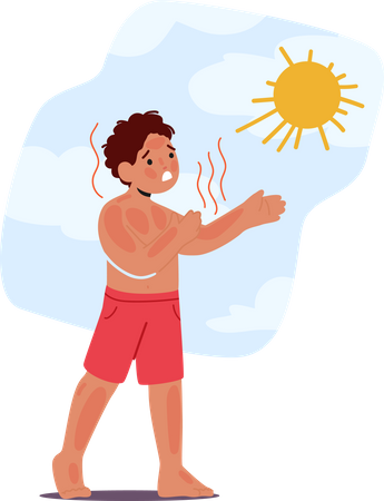 Unglückliches Kind mit schmerzhaftem Sonnenbrand  Illustration