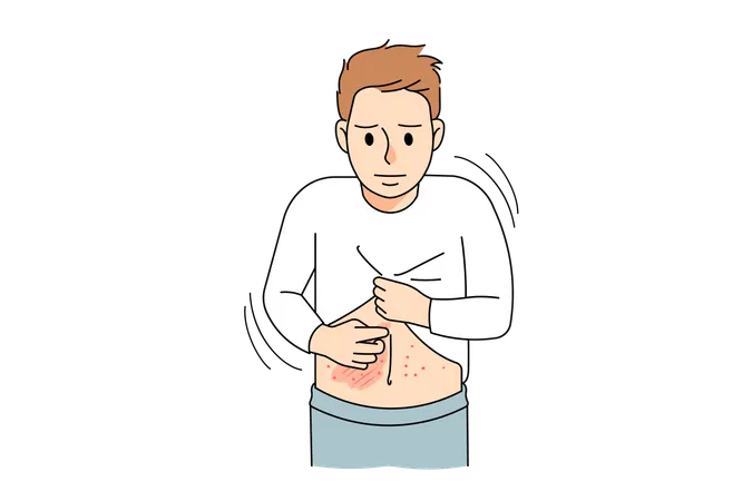 健康でない男児が皮膚のかゆみに悩まされる  イラスト