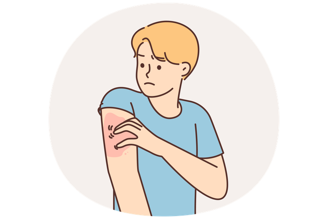 腕を掻いている不健康な男性はサル痘にかかっている  イラスト