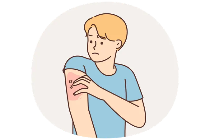 腕を掻いている不健康な男性はサル痘にかかっている  イラスト