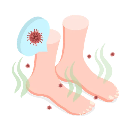 3 D Isometric Flat Vector Illustration Of Feet Unpleasant Smell Fungal Lesions Illustration
