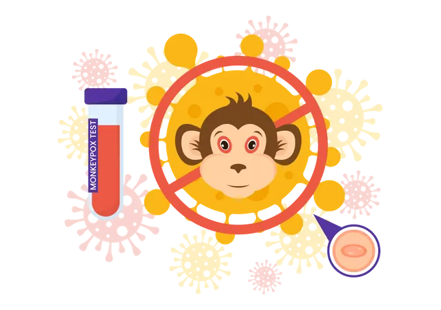 Épidémie de variole du singe  Illustration