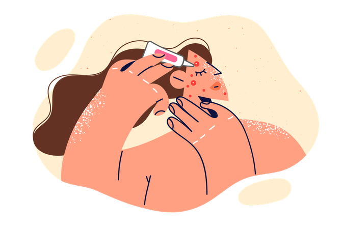 Woman applies cream on face pimple  Illustration