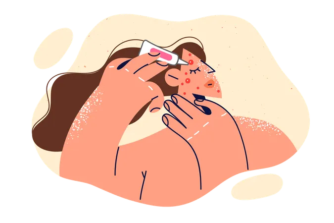 Woman Applies Cream To Pimple On Face Fights Rash Or Redness Associated With Puberty Girl Uses Cosmetics To Fight Acne And Takes Care Of Skin Wanting Become Attractive And Like Men Illustration