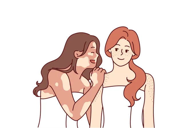 Woman With Vitiligo Syndrome Hugs Friend In Bath Towel And Laughs Enjoying Fellowship And Tolerance Two Cheerful Girlfriends With Freckles On Skin Or Spots Associated With Vitiligo Pigmentation Illustration