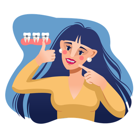 Woman demonstrates dental braces installed by dentist from dental clinic to improve smile  Illustration