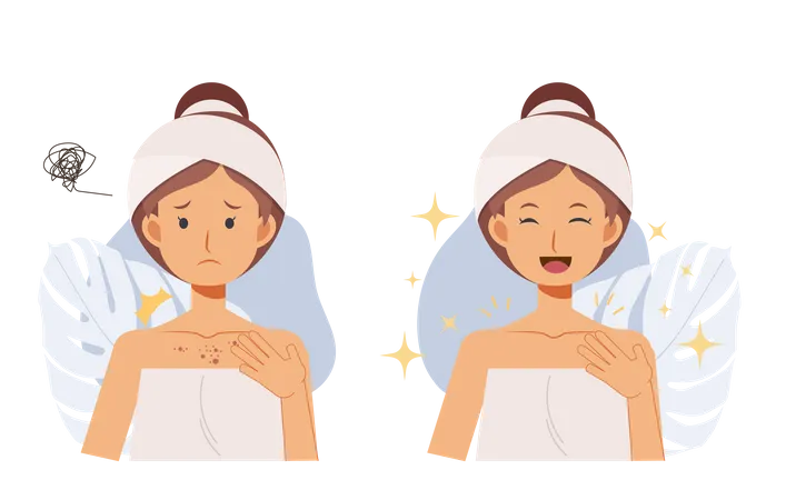 Skin Care Concept Acne Treatment Woman With Acne On Her Chest Before And After Flat Vector Cartoob Character Illustration Illustration