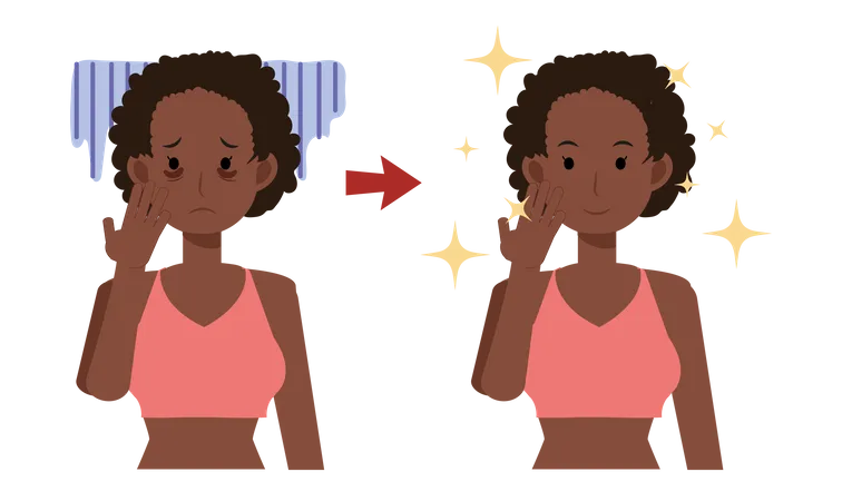 Skin Care Beauty Concept Illustration African American Woman With Dark Circles On Face Woman Worried About Dark Circles Before After Flat Vector Cartoon Character Illustration イラスト