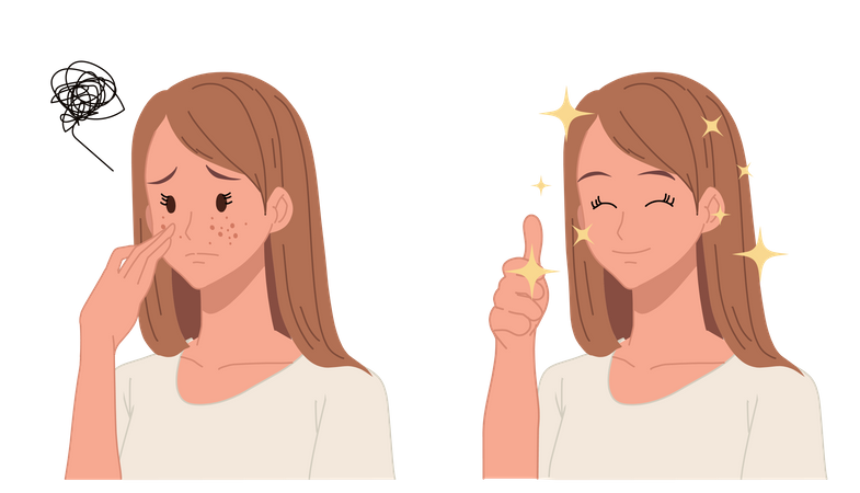 Woman feeling after acne treatment Illustration