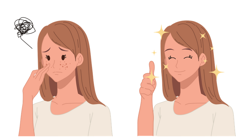 Woman feeling after acne treatment  Illustration