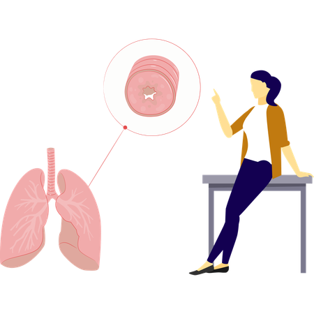 Woman is pointing lungs bronchioles  Illustration