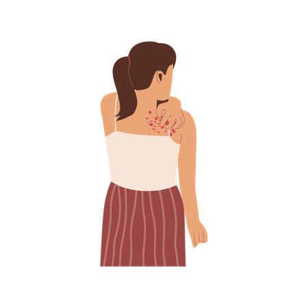 Woman scratching rashes  Illustration