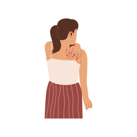 Woman Scratching Body Rash Allergy On Skin Illustration For Websites Landing Pages Mobile Applications Posters And Banners Trendy Flat Vector Illustration Illustration