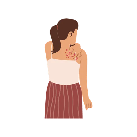 Woman scratching rashes  Illustration