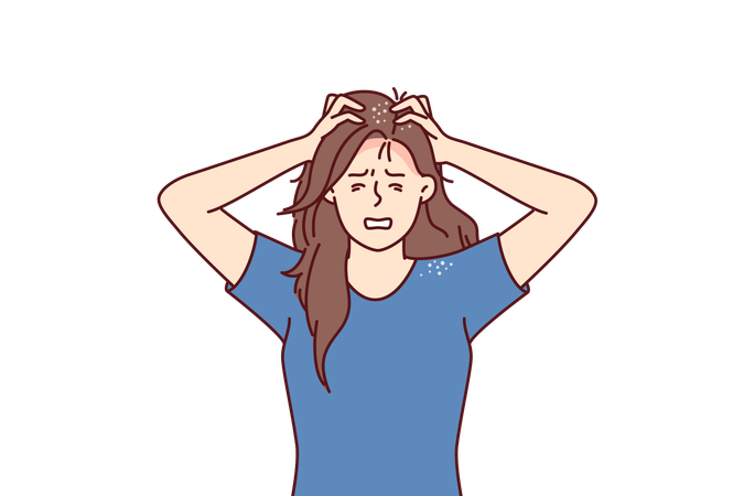 Woman suffers from itchy head after fungal infection and dandruff associated with bad hair shampoo  イラスト