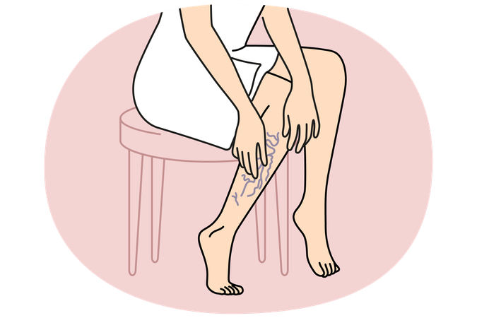 Woman touching legs with varicose veins  Illustration