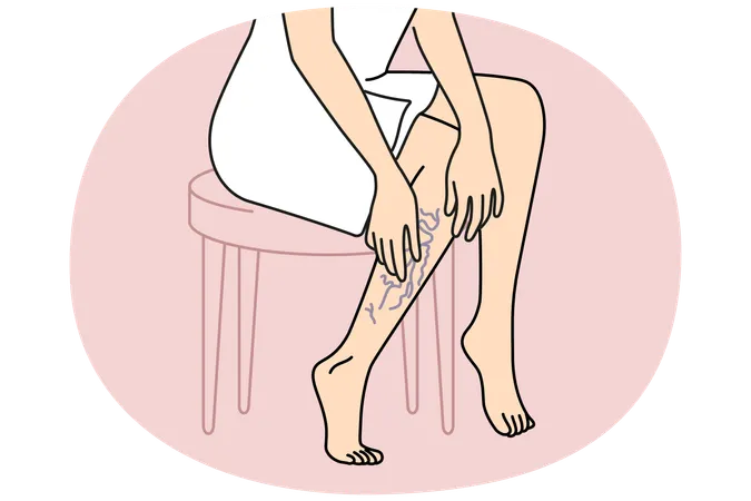 Woman touching legs with varicose veins  Illustration