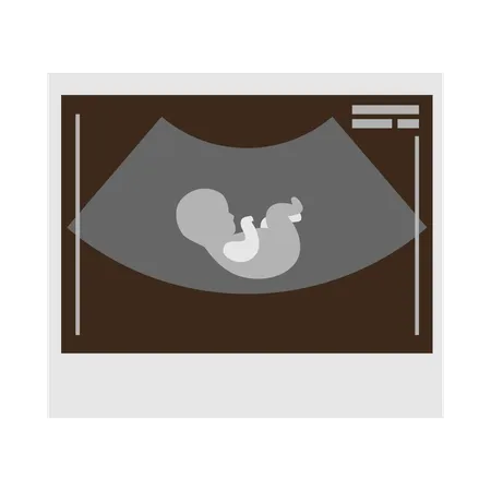 Woman viewing at sonography report  Illustration