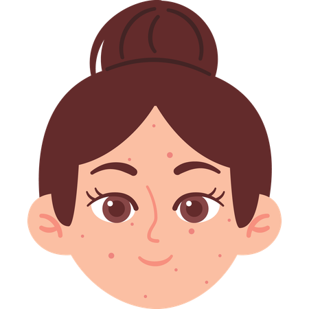 Woman with Acne Skin  Illustration