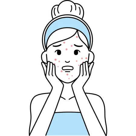 Woman with Acne Skin  Illustration