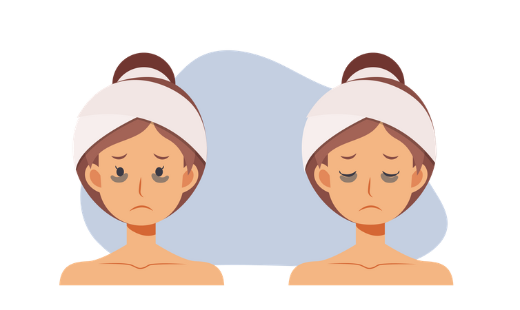 Woman with dark circles on face Illustration