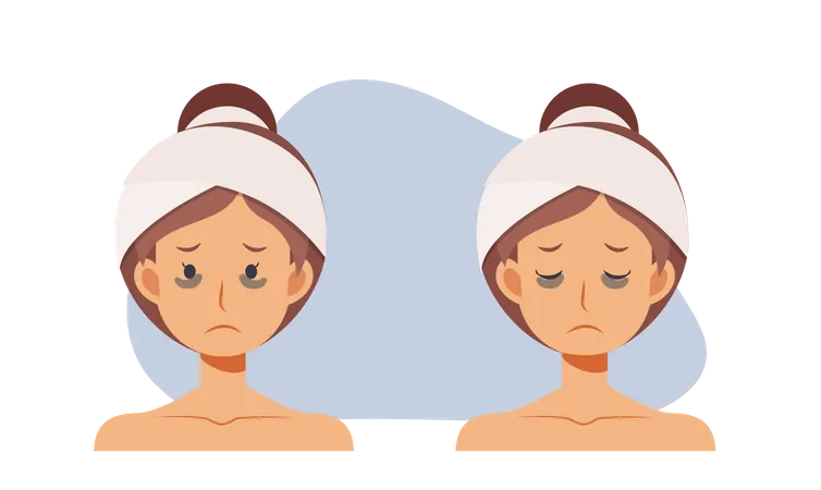 Skin Care Beauty Concept Illustration Woman With Dark Circles On Face Woman Worried About Dark Circles Flat Vector Cartoon Character Illustration イラスト