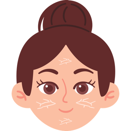Woman with Dry Skin  イラスト
