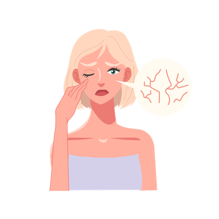 Woman with Dry Skin and Wrinkles Close-Up  Illustration