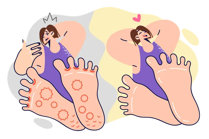 Woman with foot fungus before and after using medicinal ointment  Illustration