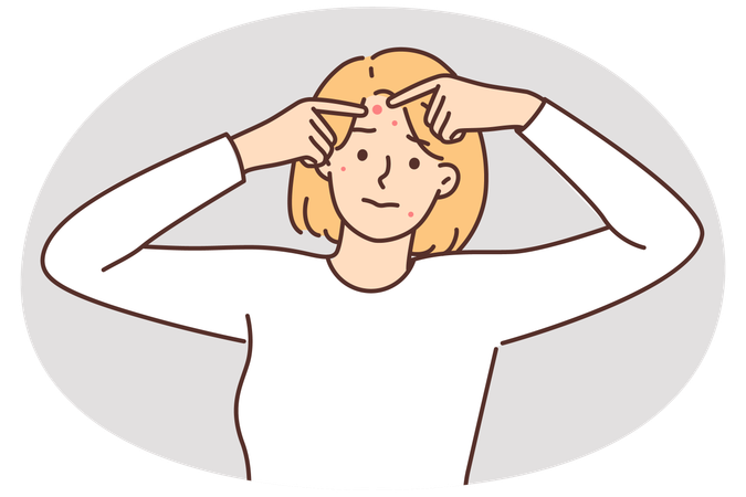 Woman with problem skin squeezes pimples from forehead in need of applying healing ointment  Illustration