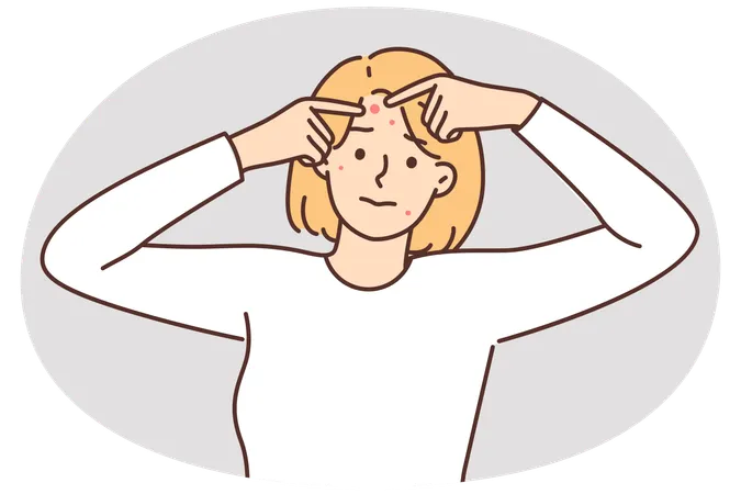 Woman with problem skin squeezes pimples from forehead in need of applying healing ointment  Illustration