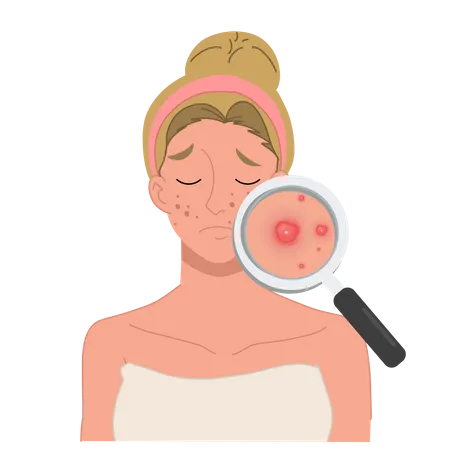 Woman with severe facial acne problem  Illustration