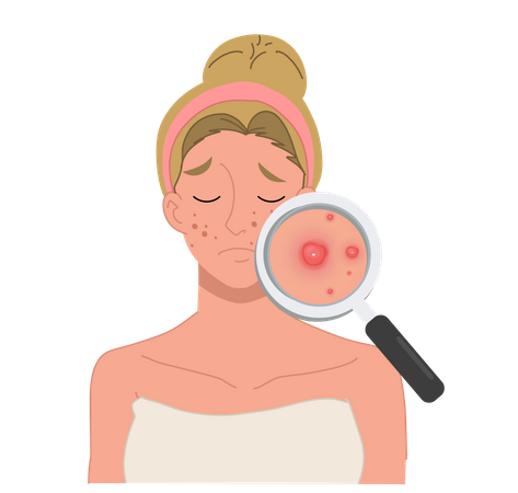 Woman with severe facial acne problem  Illustration