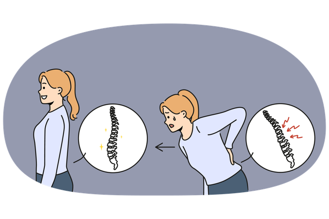Woman with sick spine near healthy girl with good posture who underwent chiropractic procedure  Illustration