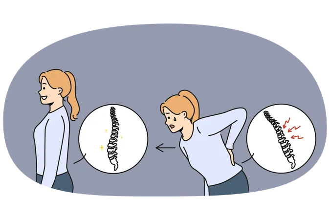 Woman with sick spine near healthy girl with good posture who underwent chiropractic procedure  Illustration