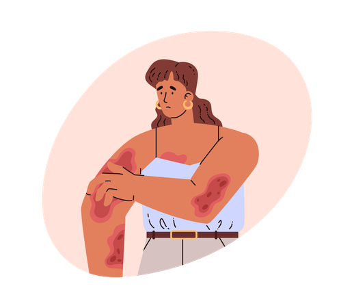 皮膚疾患のある女性  イラスト