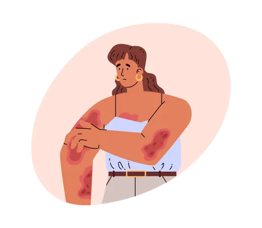 皮膚疾患のある女性  イラスト