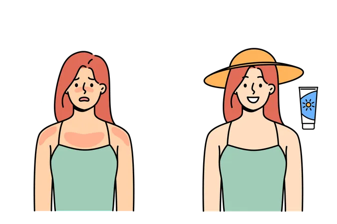 Woman with sunburn smiles after using sunscreen to protect from ultraviolet light  イラスト