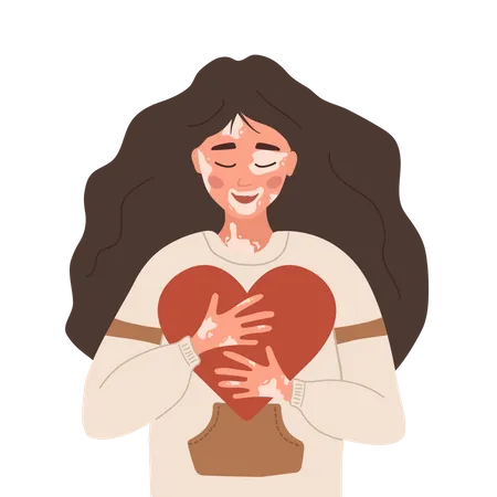 Woman With Vitiligo Self Care And Self Love World Vitiligo Day Skin Disease Happy Girl Hugging Heart Vector Illustration In Flat Cartoon Style Illustration