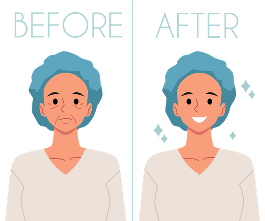 Woman with wrinkles on face Before and lady with a smooth skin After  Illustration