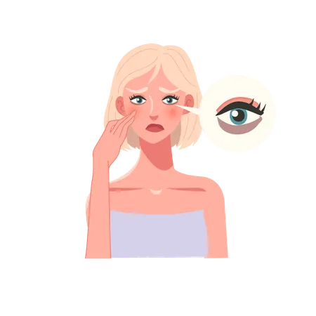 Skincare Concept Worried Woman With Dark Circles At Eyes イラスト