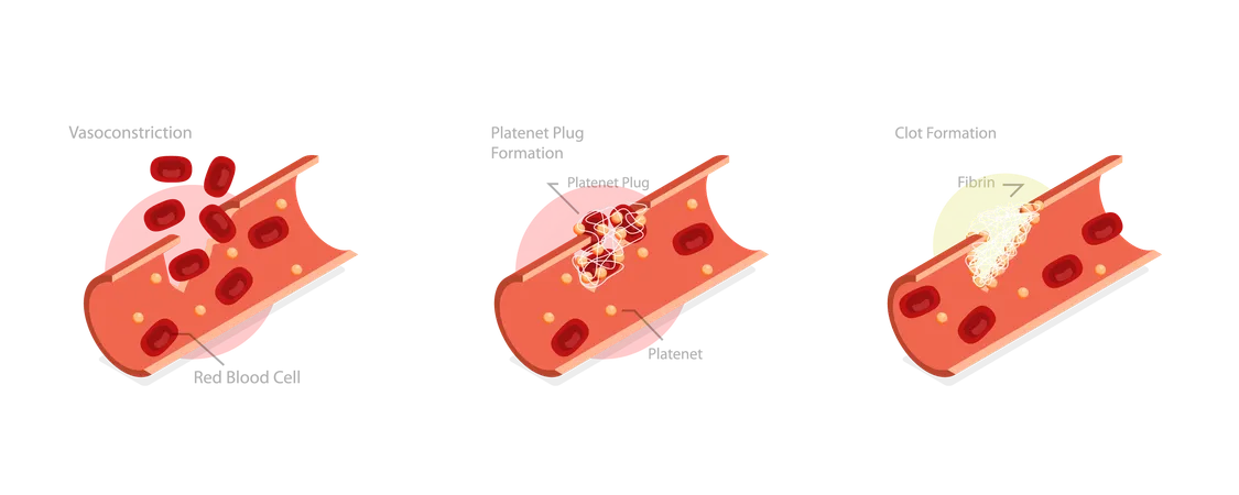 3 D Isometric Flat Vector Conceptual Illustration Of Hemostasis Wound Healing Process Stages Vasoconstriction And Clot Formation 일러스트레이션
