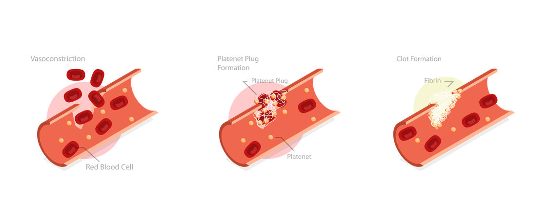 Wound Healing Process Stages  Illustration