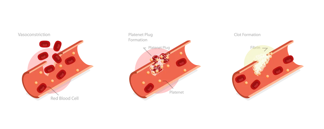 Wound Healing Process Stages  Illustration