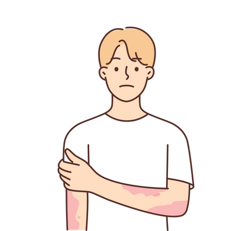 Young boy having red rashes  Illustration