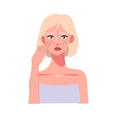 Young Woman with Acne Concern  Illustration