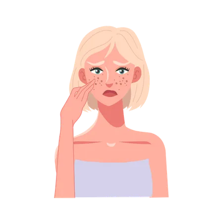 Young Woman with Acne Concern  Illustration